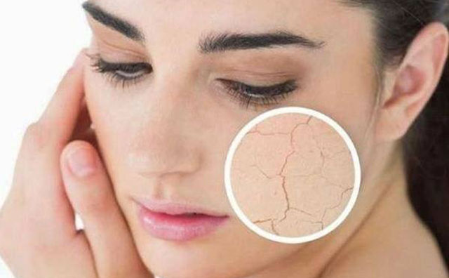 皮膚的分類-貴妍色GUIS